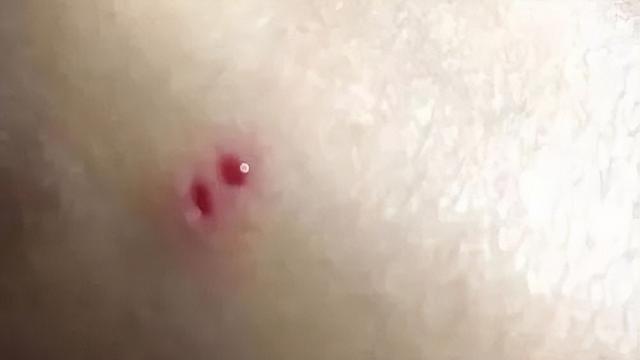 18年陕西女孩养蛇当宠物,不慎被咬伤,抢救时宁死不说是什么蛇