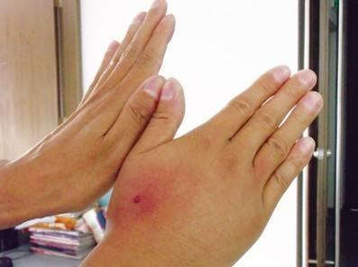 遇到马蜂“上身”,最正确的做法是什么?