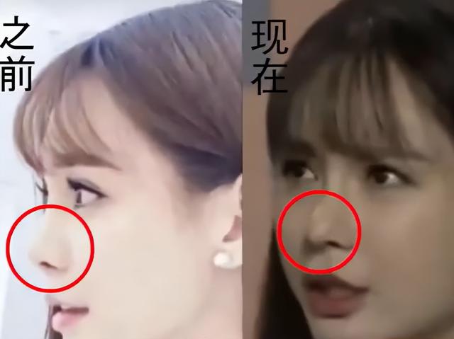 明明“歪瓜裂枣”，却能“美若天仙”，这8位女明星整得太惊艳