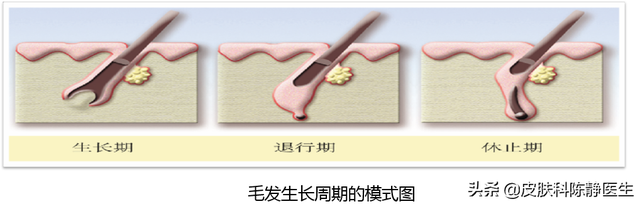 逆转女性脱发~治疗方法及进展