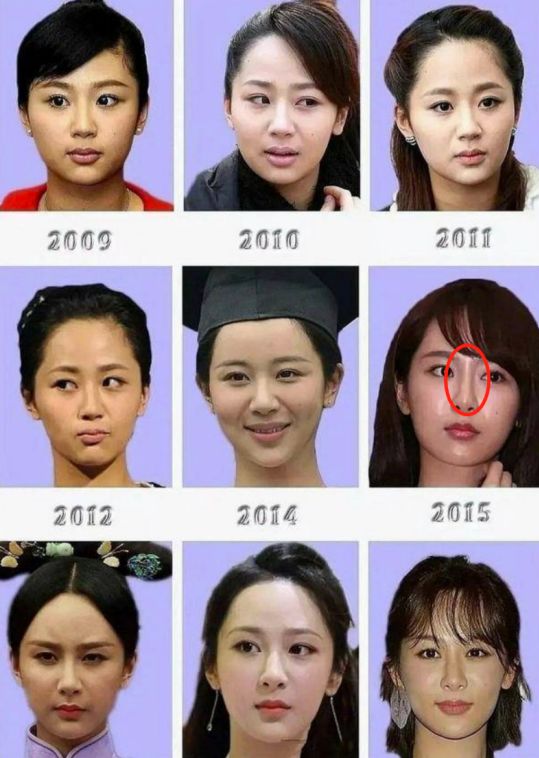 明明“歪瓜裂枣”，却能“美若天仙”，这8位女明星整得太惊艳