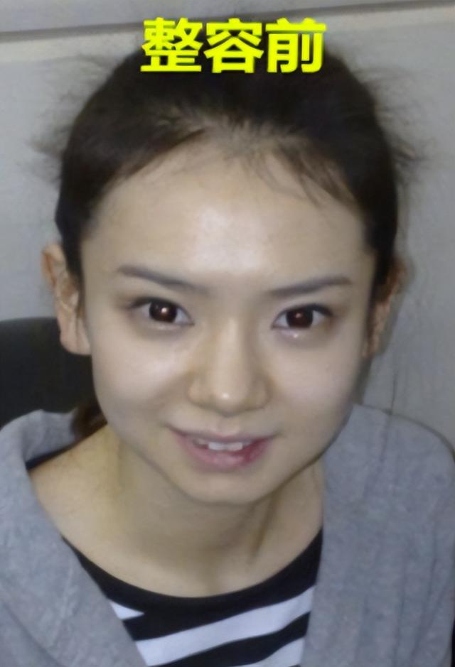 明明“歪瓜裂枣”，却能“美若天仙”，这8位女明星整得太惊艳