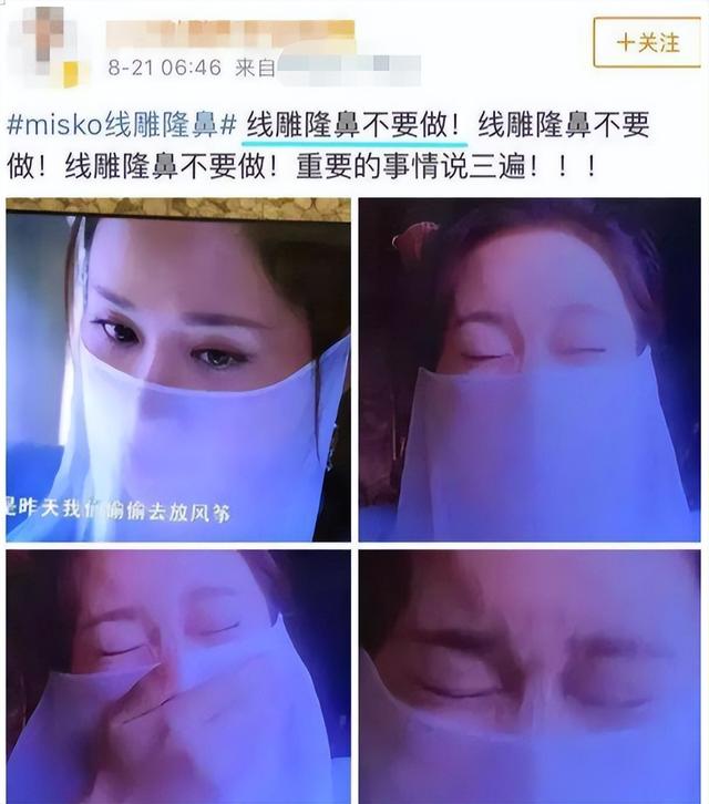 明明“歪瓜裂枣”，却能“美若天仙”，这8位女明星整得太惊艳