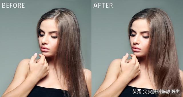 逆转女性脱发~治疗方法及进展