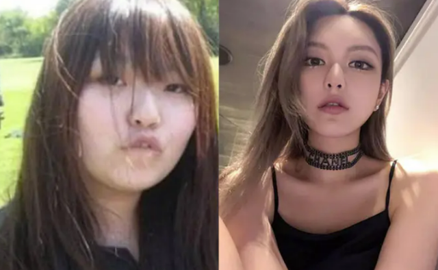 明明“歪瓜裂枣”，却能“美若天仙”，这8位女明星整得太惊艳