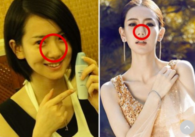 明明“歪瓜裂枣”，却能“美若天仙”，这8位女明星整得太惊艳