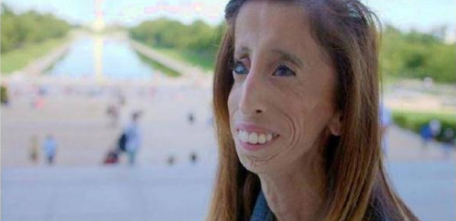 她被说世界上最丑女生,但追她的男生很多,原来内在美更重要
