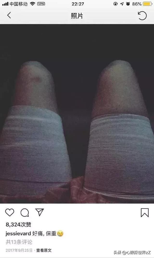 太美！19岁混血美女全网爆红，po出了自己整容的全过程