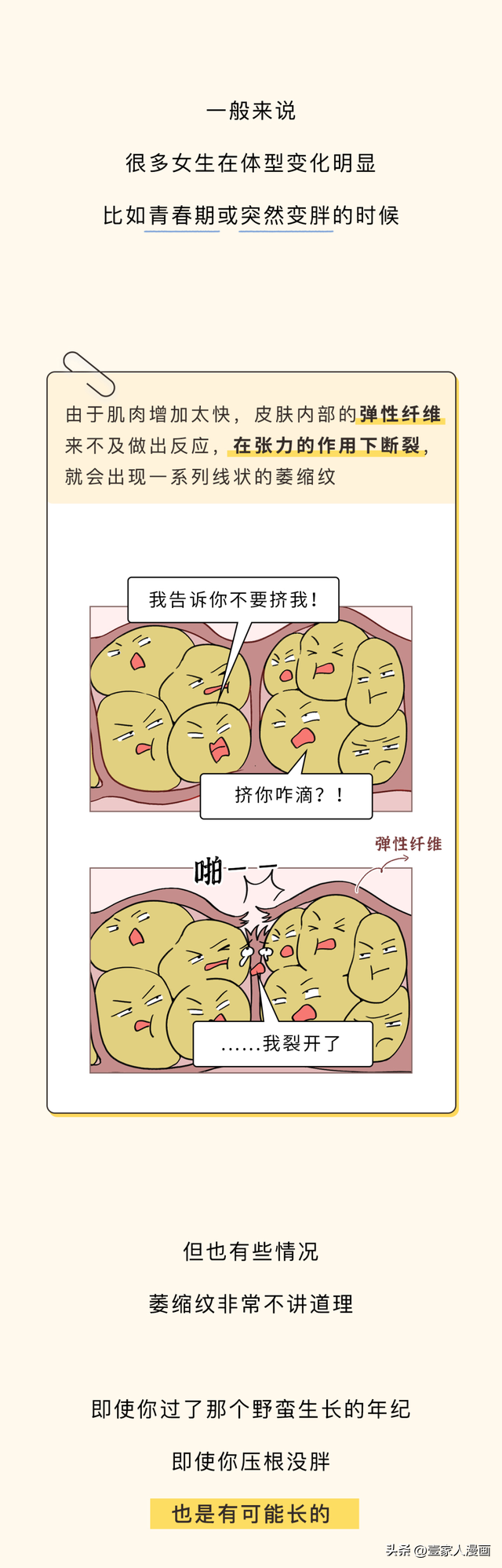 为何很多女生大腿附近会出现一片白色的条纹？