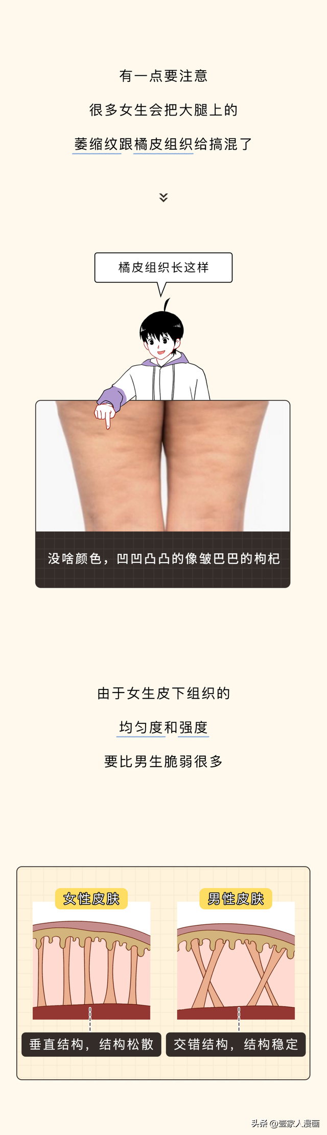 为何很多女生大腿附近会出现一片白色的条纹？