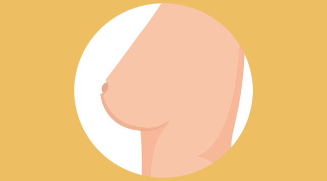 乳房出现这6种变化，是正常现象还是疾病信号？