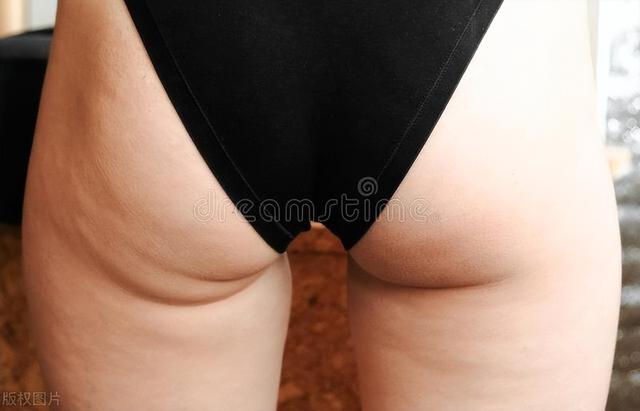 女性开始衰老的表现：3松2大1处毛增多，若没有，别害羞是好事