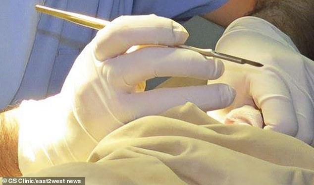 又一惨剧！意父母因手术费昂贵强行对5个月大儿子割礼致其死亡