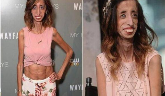 她被说世界上最丑女生,但追她的男生很多,原来内在美更重要
