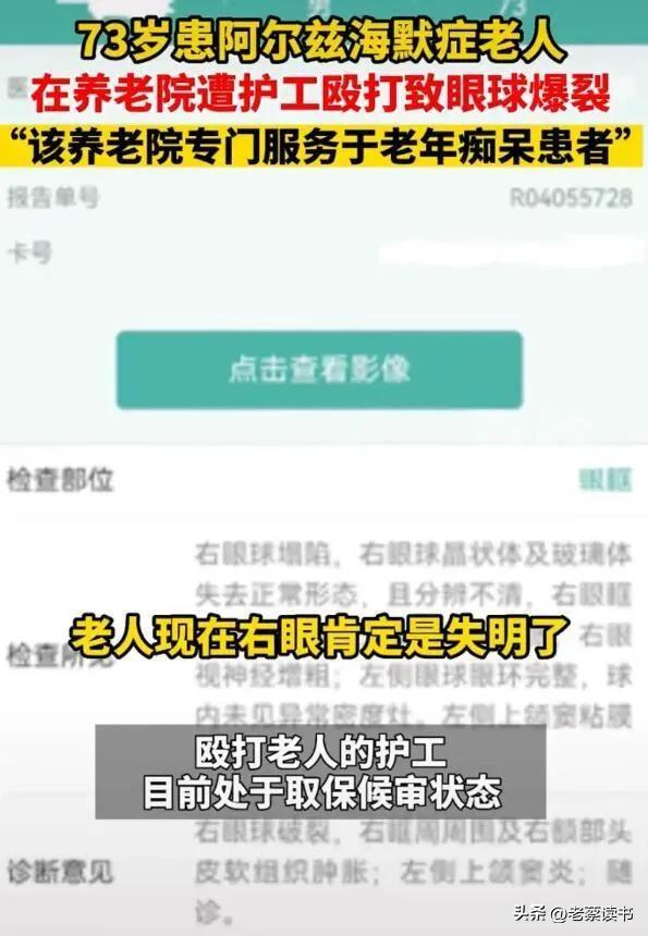 太气愤!保姆虐待87岁骨折老人让其吃排泄物 ,关注老人健康