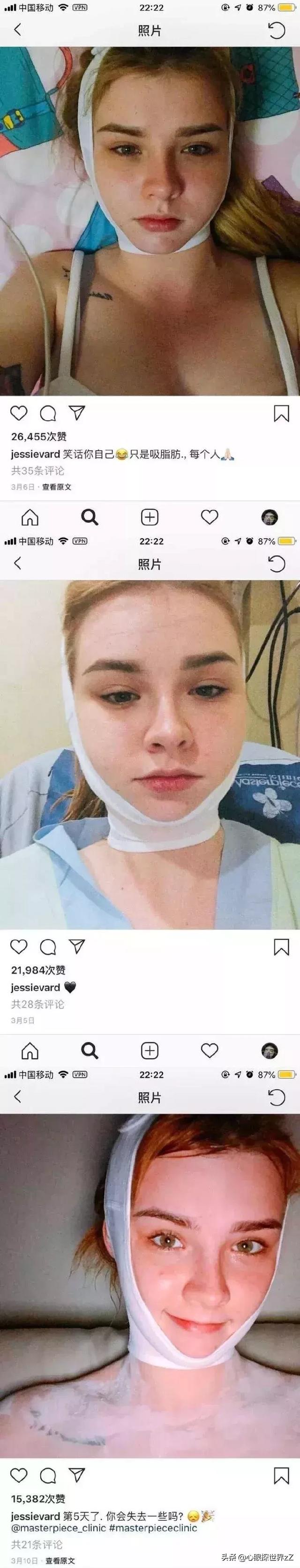 太美！19岁混血美女全网爆红，po出了自己整容的全过程