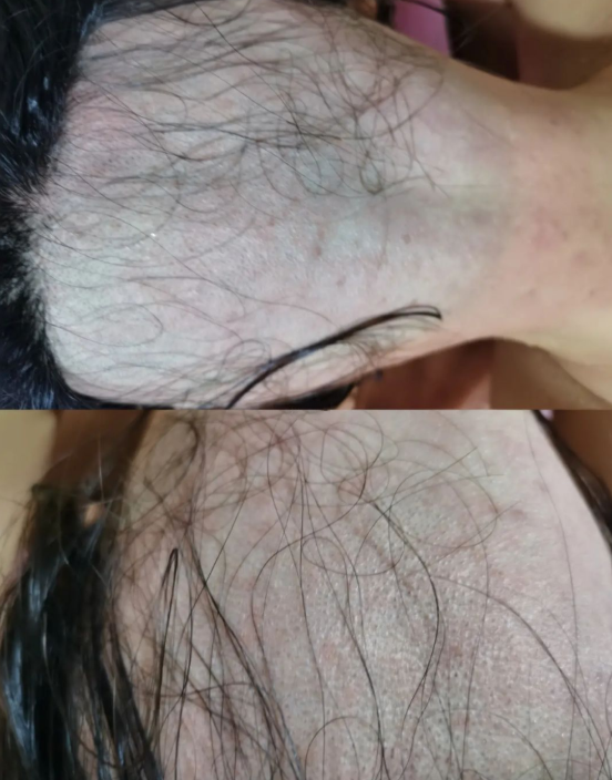 女子当发模被骗剃光后脑勺,维权牵出一条迎合怪癖的产业链