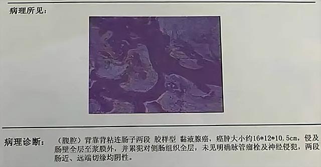 2019年,武汉“最美军嫂”不幸患癌离世,弥留时的一句话让人泪奔