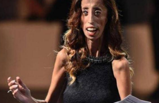 她被说世界上最丑女生,但追她的男生很多,原来内在美更重要