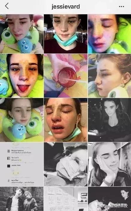 太美！19岁混血美女全网爆红，po出了自己整容的全过程