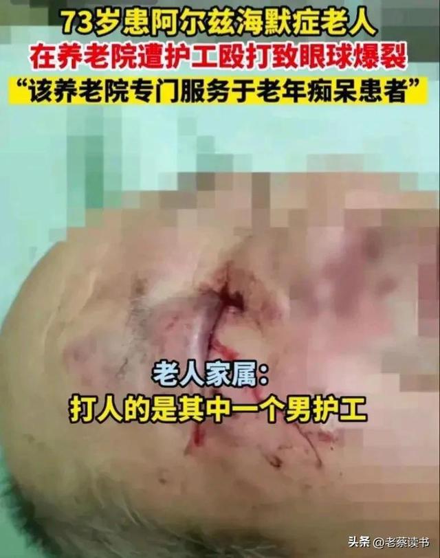 太气愤!保姆虐待87岁骨折老人让其吃排泄物 ,关注老人健康