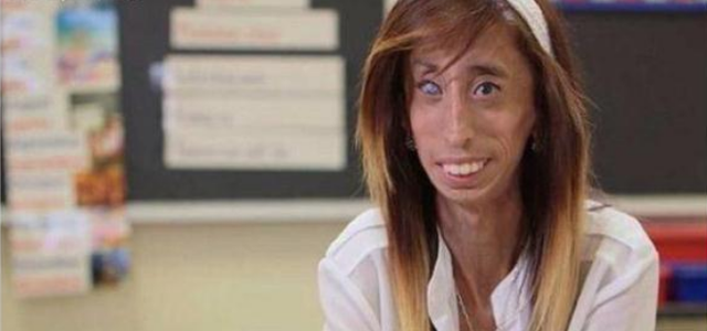 她被说世界上最丑女生,但追她的男生很多,原来内在美更重要