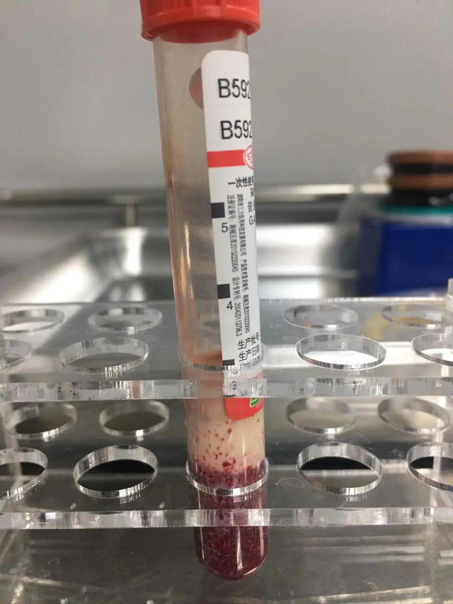 每天1杯奶茶,22岁女老师午休时突然昏迷小便失禁,更可怕的是…