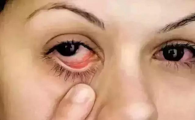左眼跳财，右眼跳灾？这几类眼皮跳真要当心了！三招教你护好眼