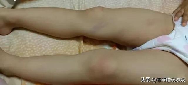3岁女童被亲爷奶狂扇7分钟耳光,其亲母不愿离婚