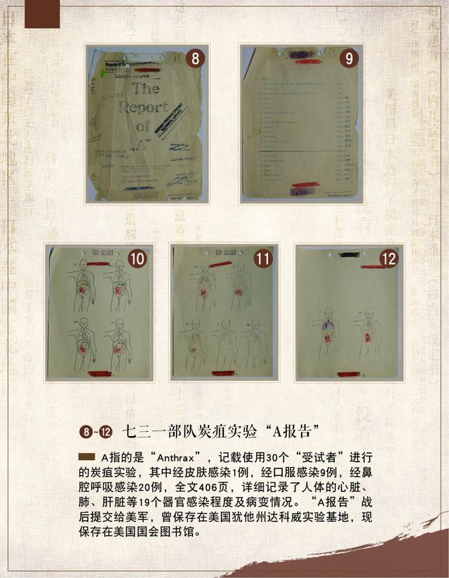 揭秘！德特里克堡基地花25万日元从731部队买走了什么？