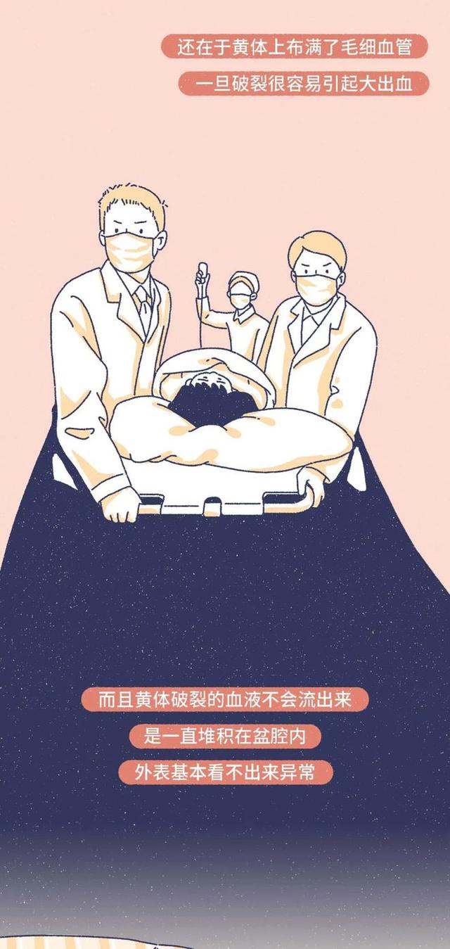 「黄体破裂」有多“可怕”？漫画：其痛苦程度，或许让人难以忍受