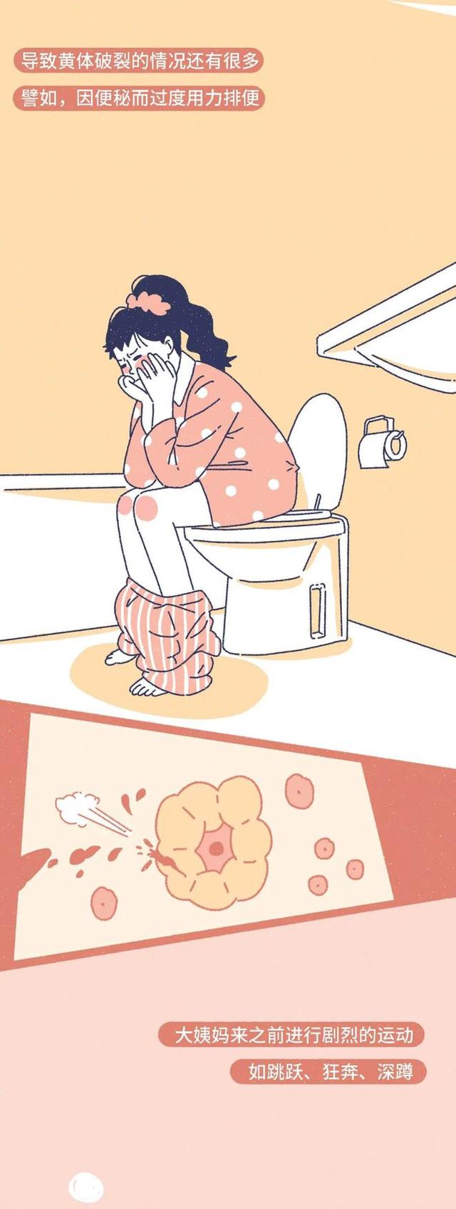 「黄体破裂」有多“可怕”？漫画：其痛苦程度，或许让人难以忍受