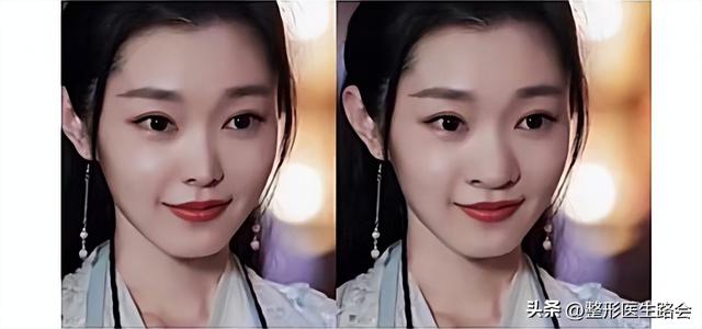 为什么塌鼻子的宋轶还那么美？她的变美思路值得很多女孩子借鉴
