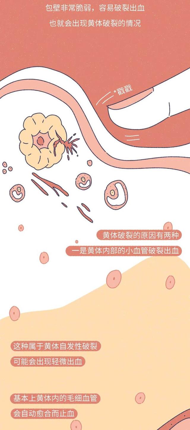 「黄体破裂」有多“可怕”？漫画：其痛苦程度，或许让人难以忍受