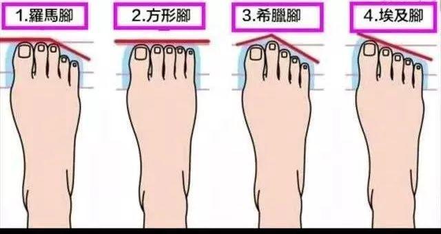「提醒」罗马脚、希腊脚…连自己的脚都不了解，怪不得不舒服