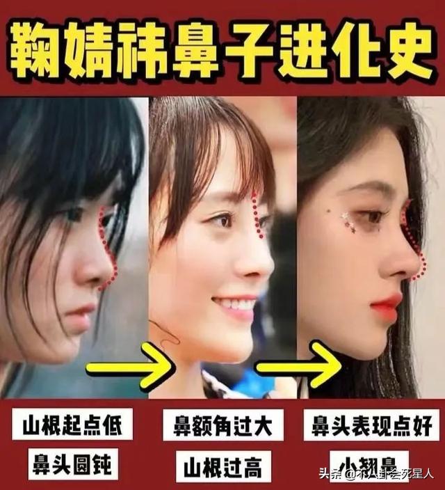 有种“整容”叫鼻子变了,萧亚轩近照像格格巫,袁姗姗认不出