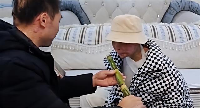 24岁女孩烧伤928天后重生!12次手术仍不放弃,向河南灾情捐500元