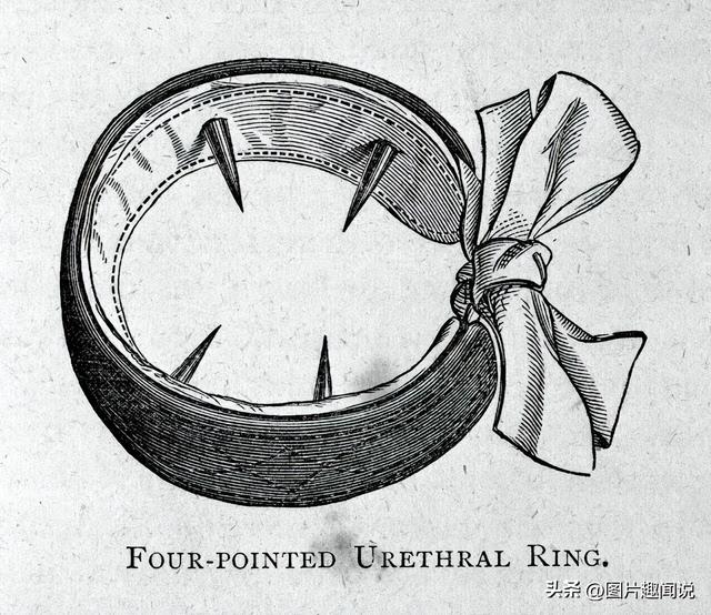 精彩照片看世界：百年前预防手淫的器具，卡扎菲的纯金手枪