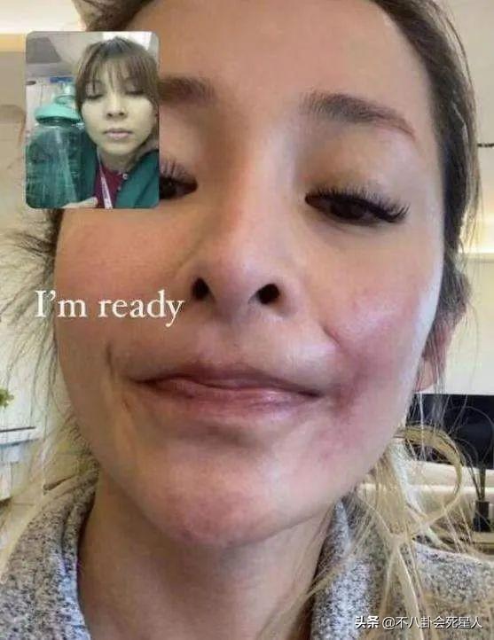 有种“整容”叫鼻子变了,萧亚轩近照像格格巫,袁姗姗认不出