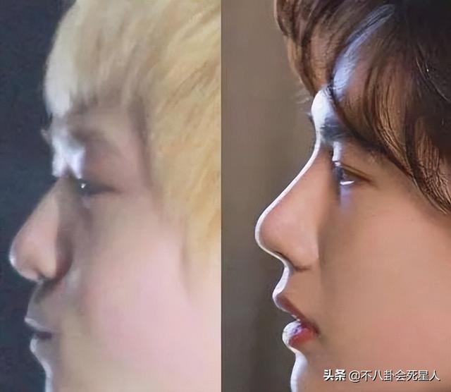 有种“整容”叫鼻子变了,萧亚轩近照像格格巫,袁姗姗认不出