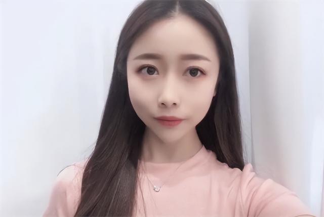 24岁女孩烧伤928天后重生!12次手术仍不放弃,向河南灾情捐500元