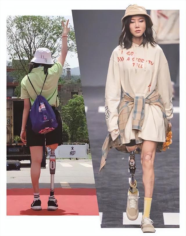 地震幸存的“钢腿女孩” 没躲过网暴，这是心理阴暗见不得别人好？