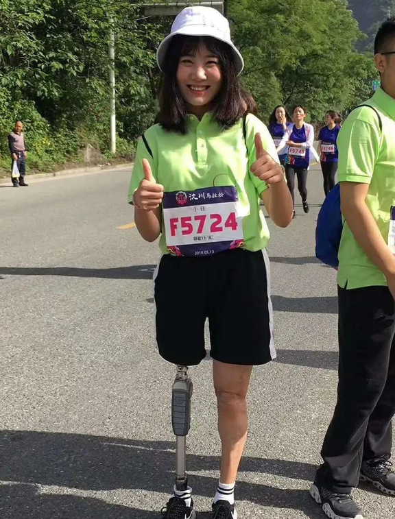 地震幸存的“钢腿女孩” 没躲过网暴，这是心理阴暗见不得别人好？