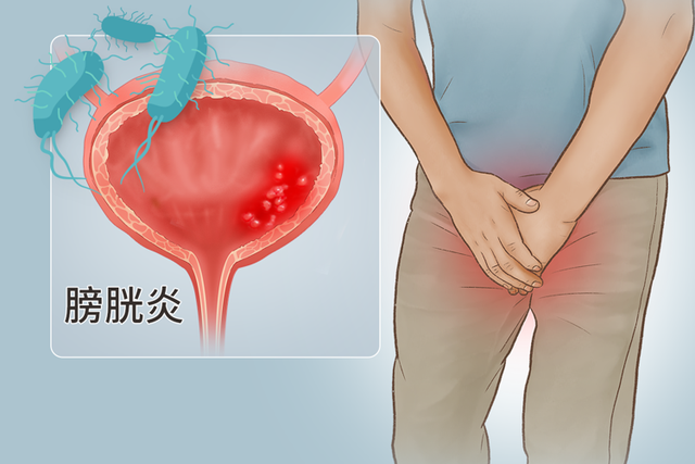 ​一位单身女青年的疑惑：性生活时，男人尿尿和射精会同时发生吗？