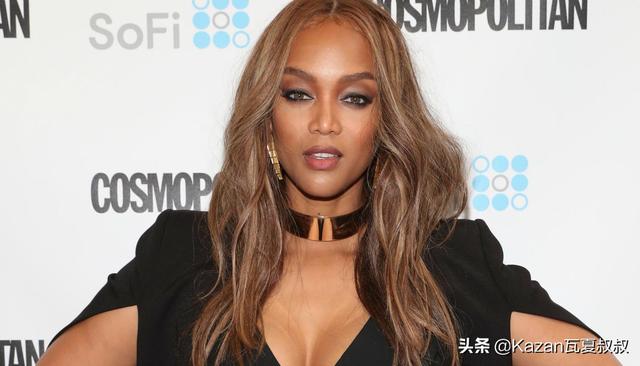 她患有严重的白癜风，但依然成为世界顶级超模，特别的美值得欣赏