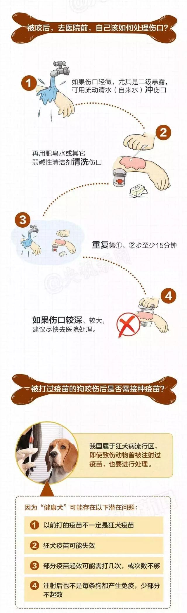 女子遛3只狗不牵绳！男子遭狗撕咬下体受伤严重，缝了30多针