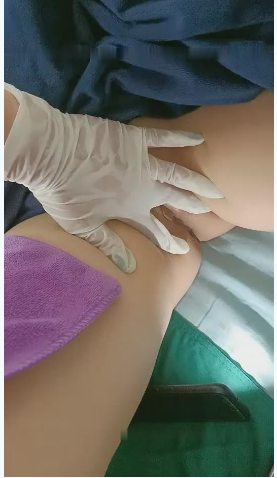 国内某民营整形美容会所天津极品大奶粉笔一线天医师偷拍给18岁的姑娘处女膜修复术