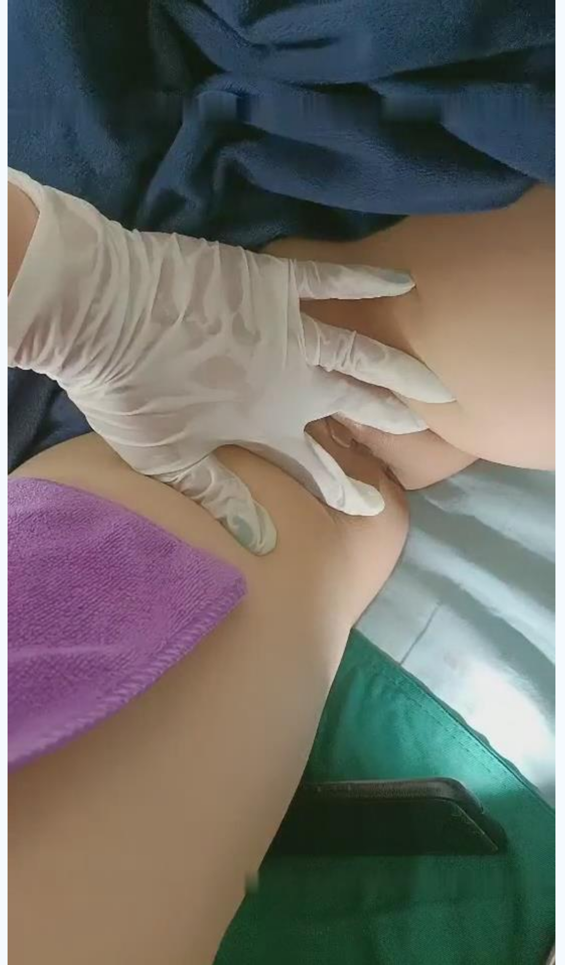 国内某民营整形美容会所天津极品大奶粉笔一线天医师偷拍给18岁的姑娘处女膜修复术