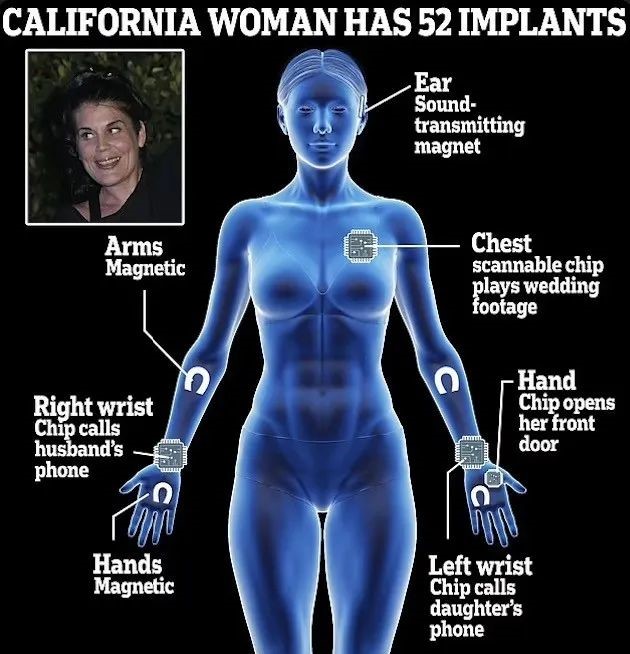 她给自己植入52个电子元件:挥手开门锁 隔墙探电线…