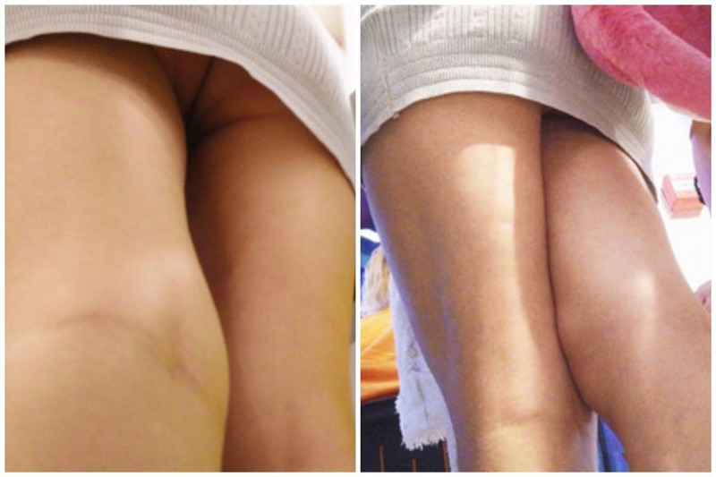 大型购物中心抄底极品包臀裙美女性感骚丁偶现小骚B